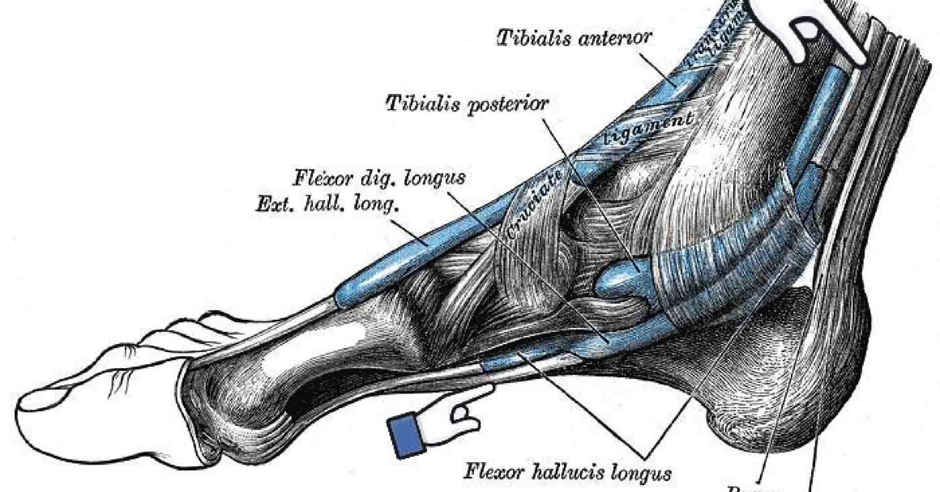 hội chứng ống cổ chân